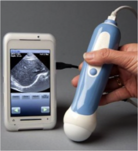 Mobile ultrasound